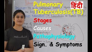 Pulmonary Tuberculosis in Hindi  Stages  Causes  Pathophysiology  Sign amp Symptoms [upl. by Ankeny]