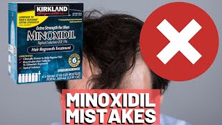 5 BIGGEST MISTAKES When Using Minoxidil REVEALED [upl. by Atrim]