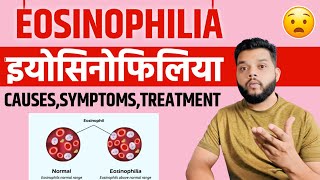 Eosinophilia Causes Symptoms amp Treatment In Hindi [upl. by Marlea]