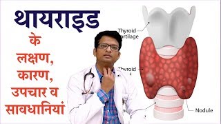 Thyroid disease causes symptoms amp treatment  थायराइड के लक्षण कारण उपचार व सावधानियां [upl. by Ayamahs]